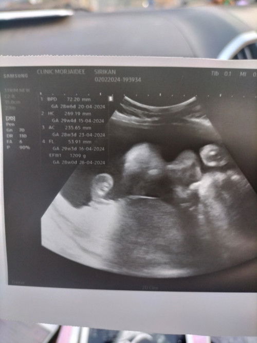 ดูยังไงว่าลูกน้อยได้กี่สัปดาห์