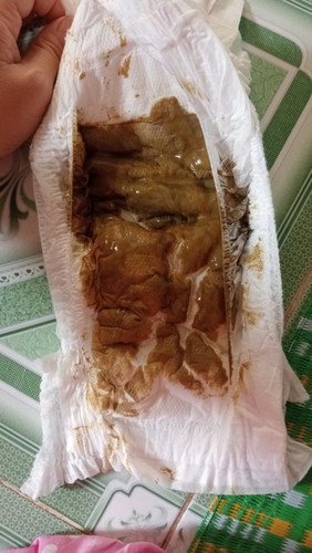 Con e 3 tháng 13 ngày đi phân màu này có sao không ạ.. các mom chỉ dạy e với..