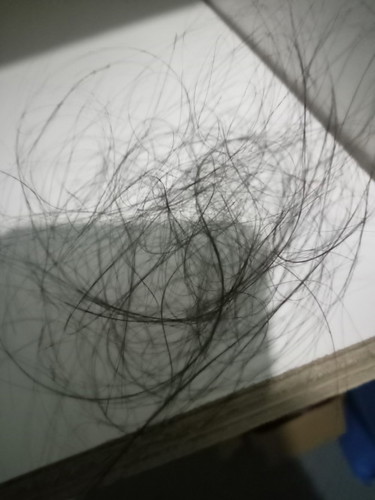 Habis lahiran September sampe skrng rontok parah