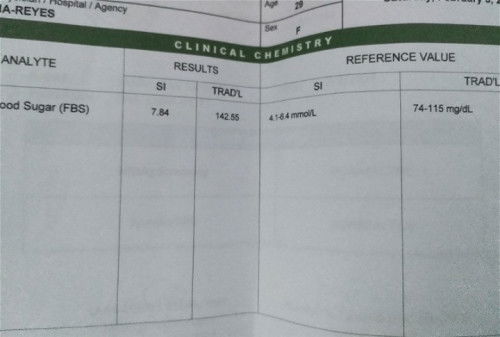 FBS above normal advice please