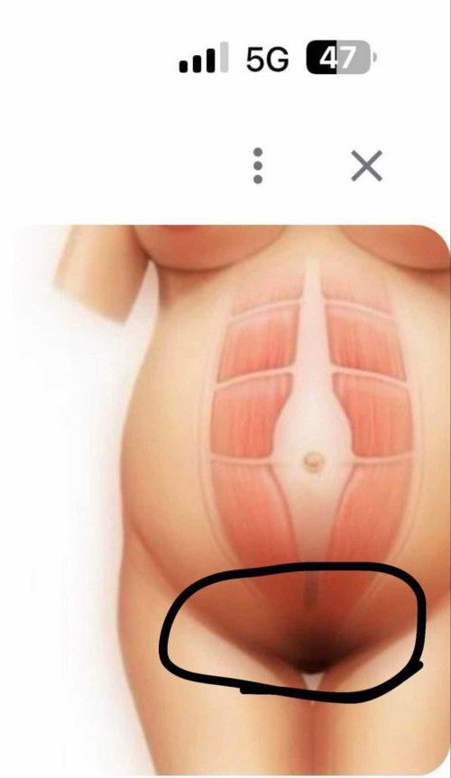 ปวดจี๊ดๆ ปวดหน่วงๆ