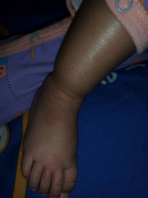 Kulit bersisik dan merah