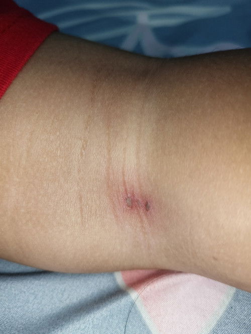 Ada yg bisa sharing pake salep apa untuk ngobatinnya bund??