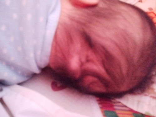 Bé nhà e 4m bị rụng 1 mãng tóc vậy là bị gì ạ các mom