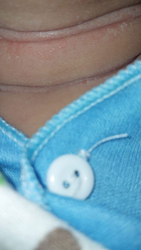 Bun ada yg leher ankny gni nd? Usia 24hari