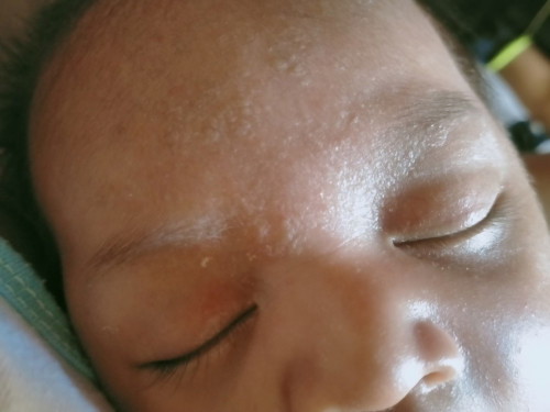 Anu po puwede iapply sa face ni baby? 3 weeks old palang po sya. or its normal lang po ba?