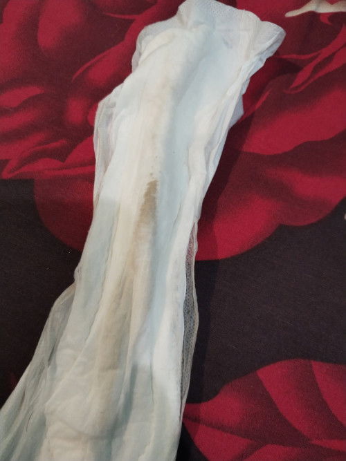 Ini flek atau apa ya bun?