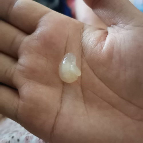 แม่ๆอันนี้คืออะไรค่ะ