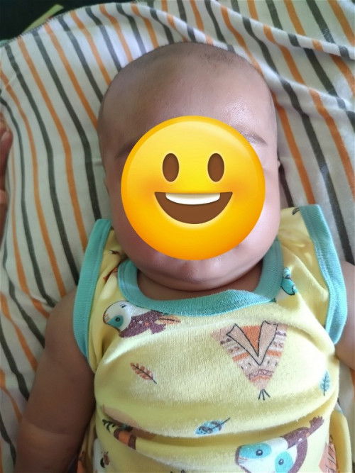 Kepala dr sisi kiri kanan dan atas normal gak??