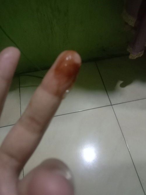 Lendir berwarna coklat