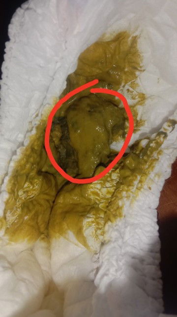 ทารก8เดือน12วัน