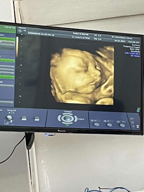 อายุครรภ์27w2d น้ำหนักเด็ก1157กรัม น้อยไปไหมคะหรือพอดี