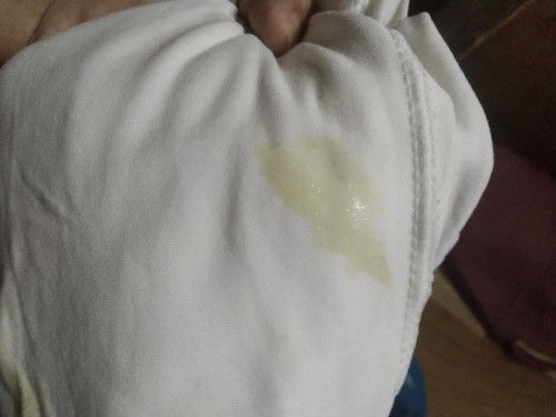 37 weeks, discharge??,  After i.e