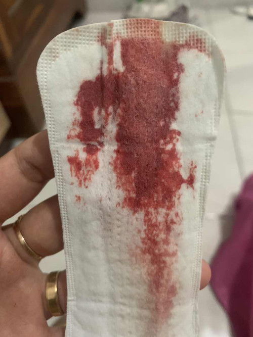 Flek darah + Gumpalan