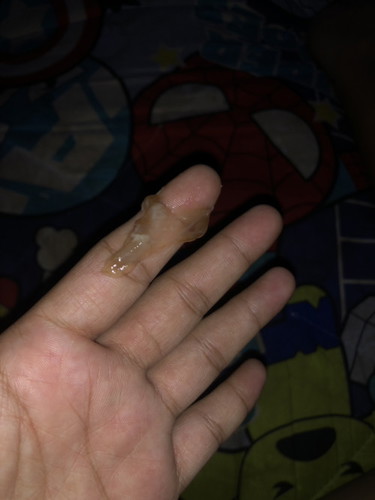 อีกนานมั้ยคะกว่าจะคลอด