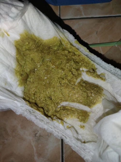 Bun bayiku awal mpasi pup nya aman, tpi 2hri ini pup hijau muda, dr awal mkan cerelac, aman gak y?