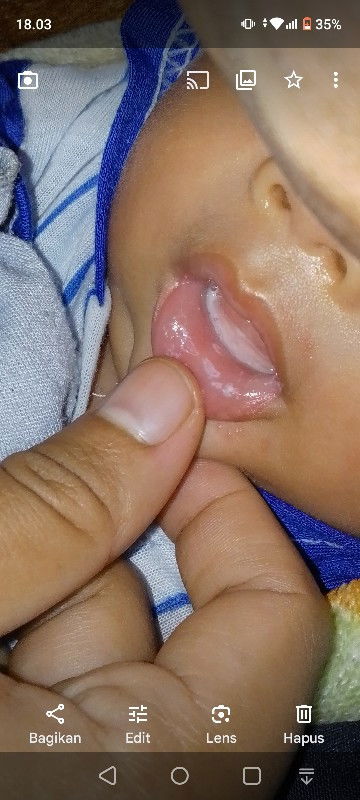 bekas asi menempel dimulut bayi