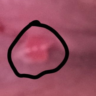 Tanong lang po tungkol sa tahi