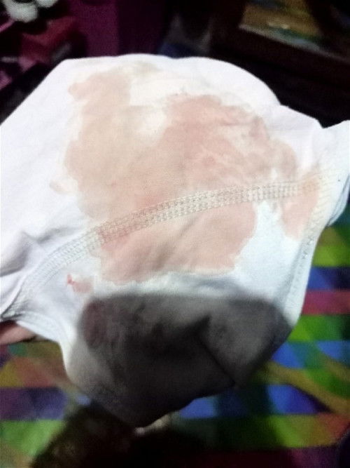 Keluar darah Warna pink di usia 11 week