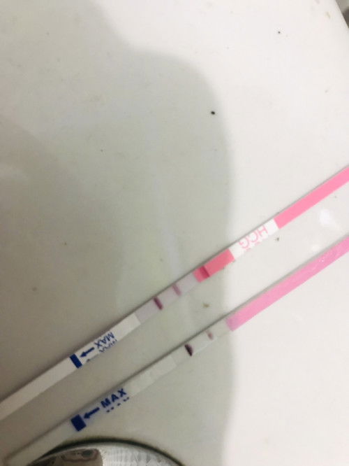 Udah Implan masih Hamil