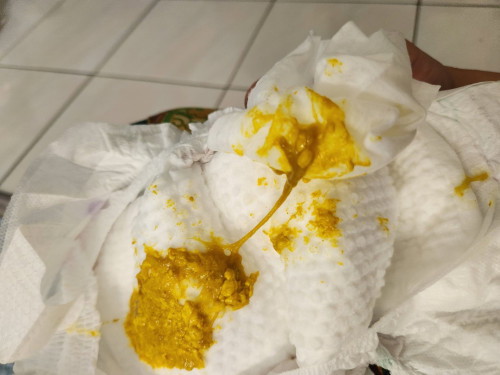 Najis baby berlendir warna nak ke hijau