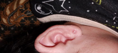 37w perut terasa sakit sekali