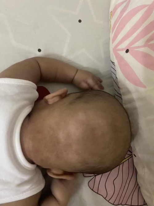 Putih2 di kulit baby