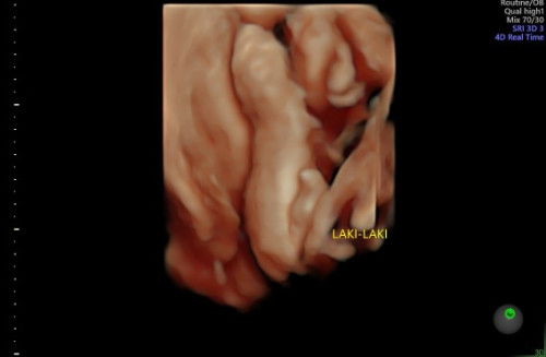 Bun bagi pengalaman nya dong