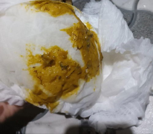 𝗕𝗮𝘆𝗶 𝟱 𝗯𝘂𝗹𝗮𝗻 𝗽𝗼𝗼𝗽 𝘀𝗲𝗽𝗲𝗿𝘁𝗶 𝗮𝗱𝗮 𝗰𝗮𝗰𝗶𝗻𝗴