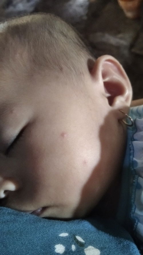 Bintik merah agak putih