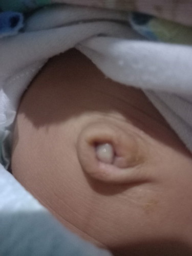 Pusar bayi 1 bulan