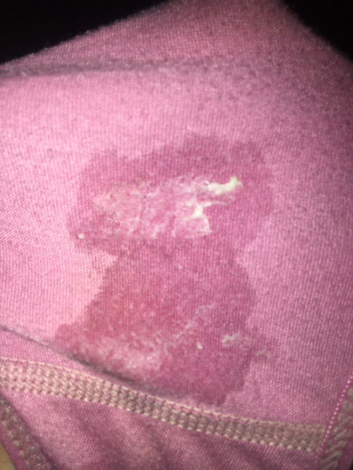 Keputihan normal gak ya