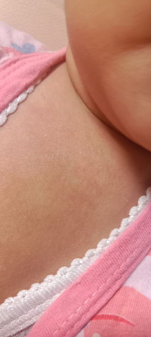 Biang keringet bandel