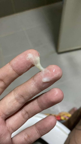 37+2 มีมูกออกมาแบบนี้หมายความว่ายังไงคะ