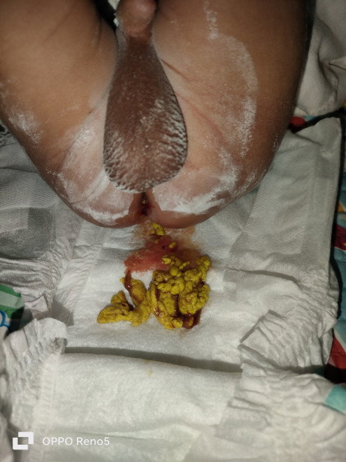 Mau bertanya ttg bayi 29 hari