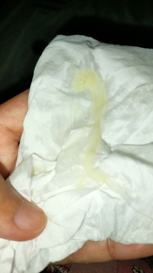 Keputihan atau lendir tanda persalinan?