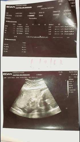 ช่วยดูให้หน่อยคะท้องแรกงงไปหมด