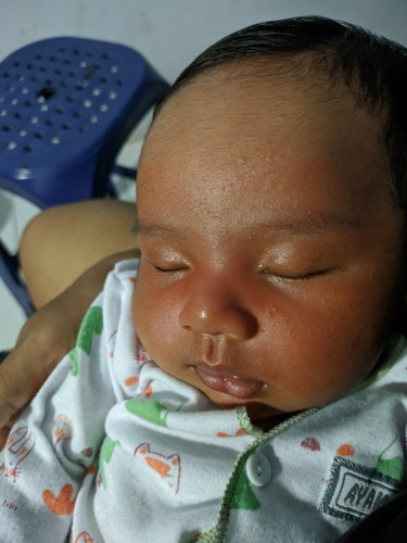 mau tanya anak aku jam 10 siang dibawa keluar rumah sama saudara pas malem mukanya kok merah gitu ya
