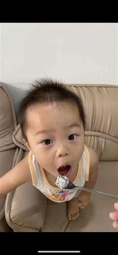 ลูกใต้ตาคล้ำมากเกิดจากอะไรได้บ้าง?