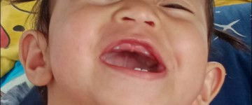 ฟันลูกน้อย