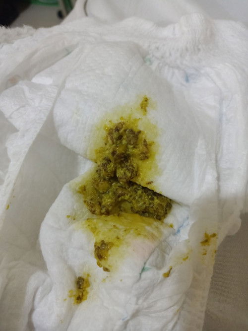 Gastro watery poop diarrhea