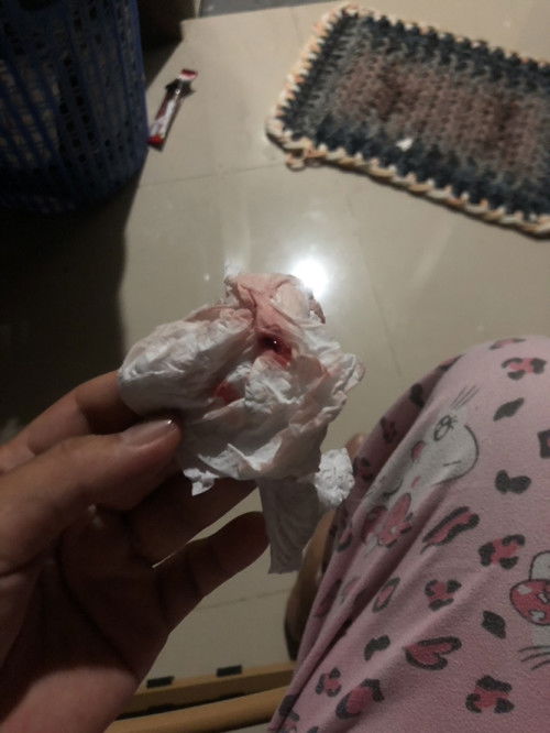 สอบถามค่ะ ท้องแรก อายุครรภ์ 39 w