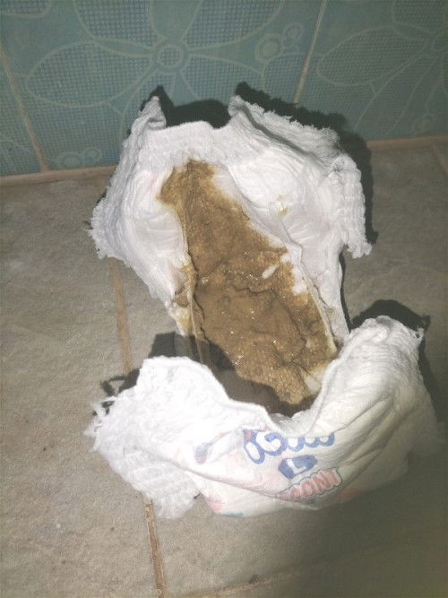 อึบ่อย อึเหลว มีกลิ่นเปรี้ยว