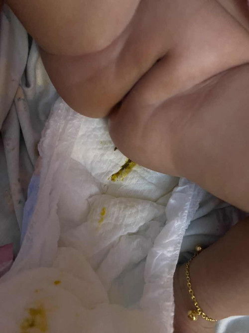 Pup bayi ini dikit bgt warna apa ya kaya ijo gt tp mirip item