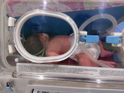 Lahir diusia 36w5d hpl 29feb