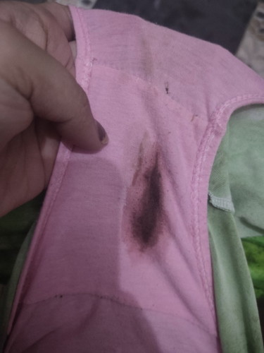 Pede na po ba Mag PT ang 3 days Delay at ganito po ba ang Implantation bleeding??