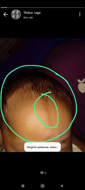 Kepala  bayi 2 bulan
