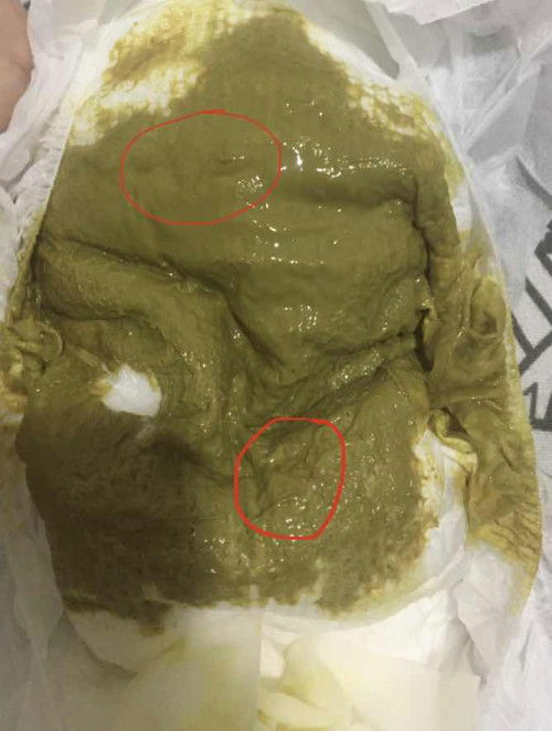 Najis bayi berlendir