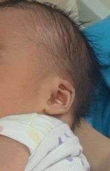 Telinga tidak sama besar