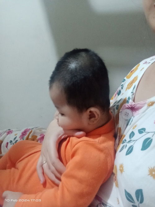Kepala bayi 4 bulan peyang